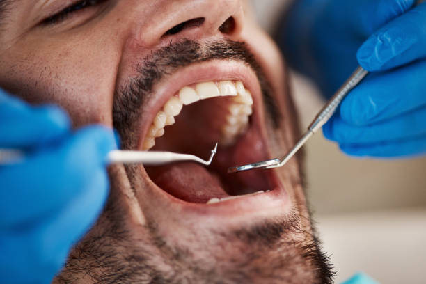Urgent Tooth Repair in SC